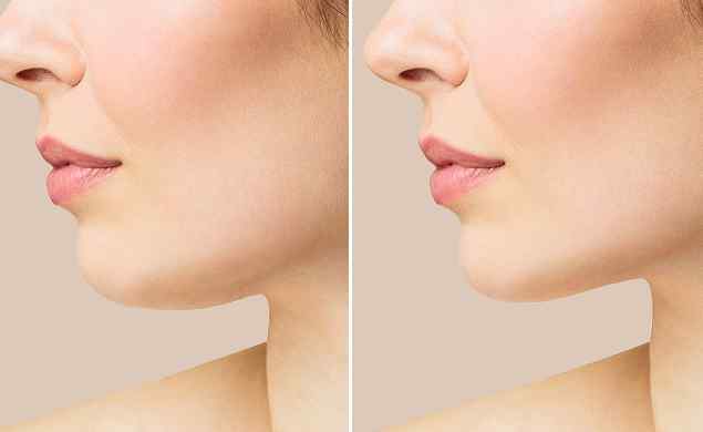 image_before_after_02 https://demo.madanglestudios.com/wp-content/uploads/2026/05/image_before_after_02.jpg